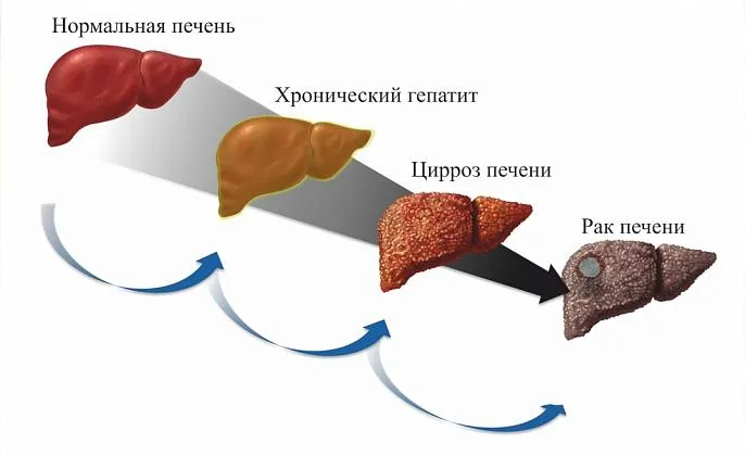 Гепатит